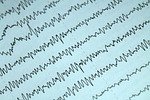 the medicine, study, electrophysiology, eeg, electroencephalography, electroencephalogram, medical, health care, the science, tech, recording, fragment, eeg, eeg, eeg, eeg, eeg